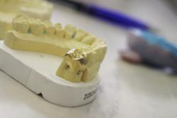 dental gold refining
